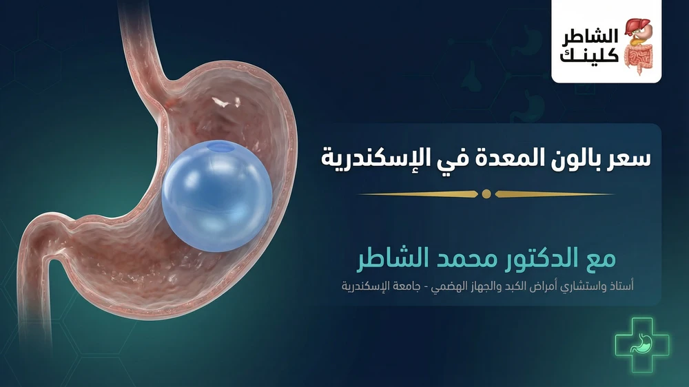 سعر بالون المعدة في الإسكندرية مع الدكتور محمد الشاطر