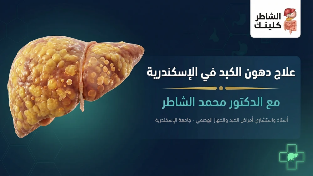 علاج دهون الكبد في الإسكندرية مع الدكتور محمد الشاطر