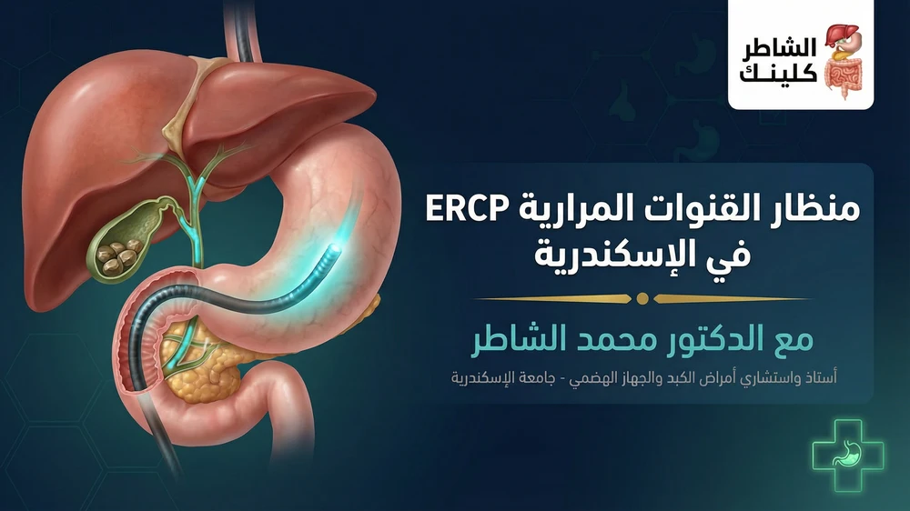 منظار القنوات المرارية ERCP في الإسكندرية مع الدكتور محمد الشاطر